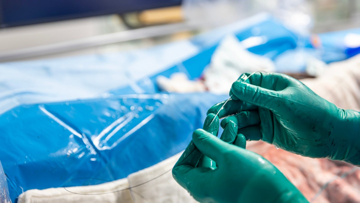 Zylox-Tonbridge to Acquire German Medtech Firm Optimed